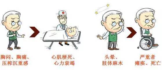 脑梗治疗新方法，科技重塑生命之光新探秘